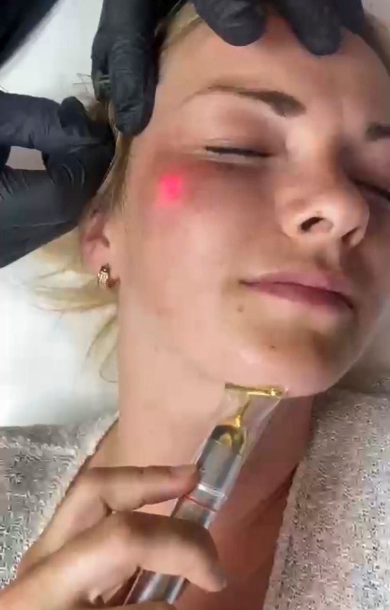 ENDOLIFT®