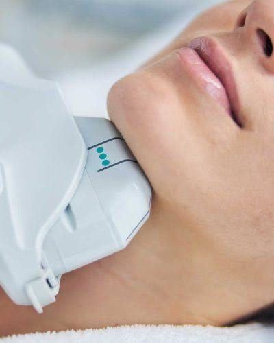 Ultherapy HIFU