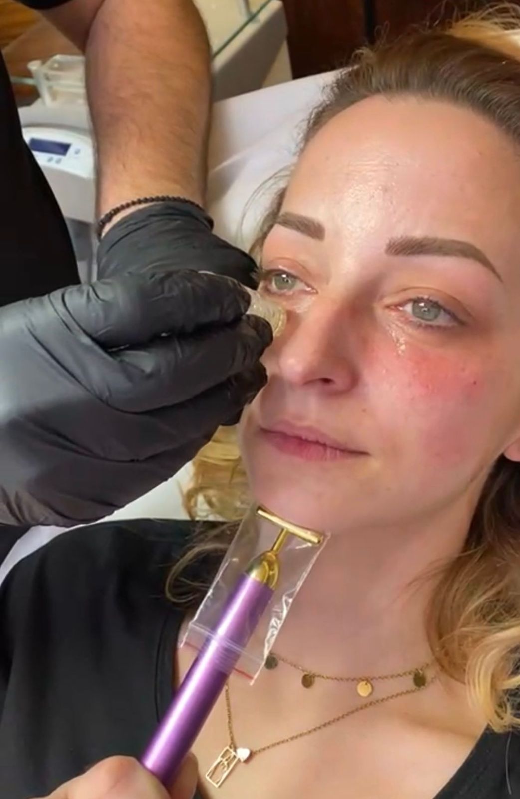 Mesotherapie